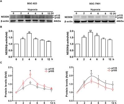 NEDD9 Facilitates Hypoxia-Induced Gastric Cancer Cell Migration via MICAL1 Related Rac1 Activation